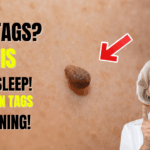 This Weird Trick Removes Skin Tags Overnight (So Simple!)