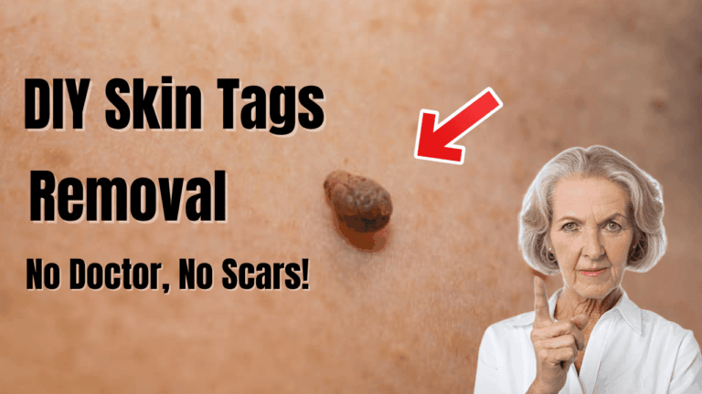 This Weird Trick Removes Skin Tags Overnight (So Simple!)