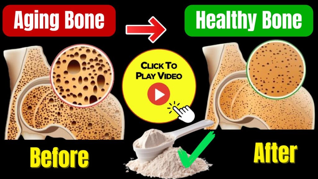 They Said Bone Loss Was Permanent — They Were Wrong 1 They Said Bone Loss Was Permanent — They Were Wrong