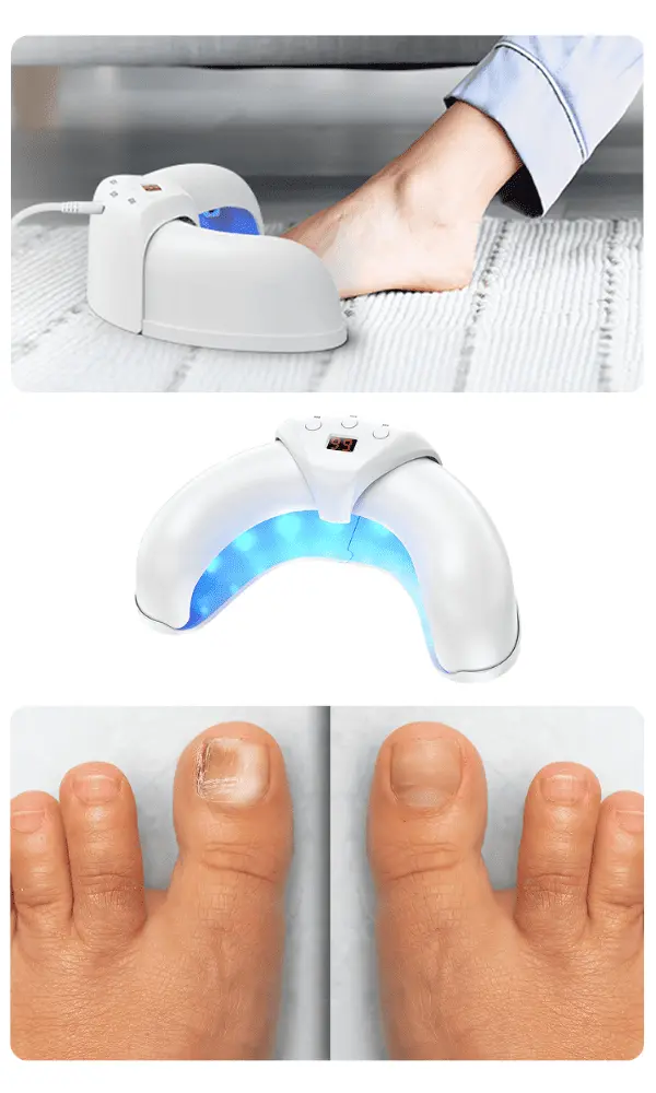 Diagram showing the internal mechanism of Fungabeam
