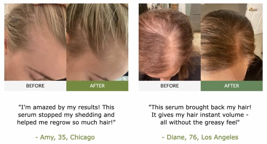 FullyVital Hair Serum Review - Do Not Buy Till You've Read This 7 From struggles to stunning: join the thousands reclaiming their hair and confidence