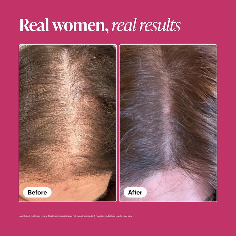 Viviscal Hair Growth Supplements for Women Review: Does It Really Work? 3 viviscal hair growth supplements for women to grow thicker