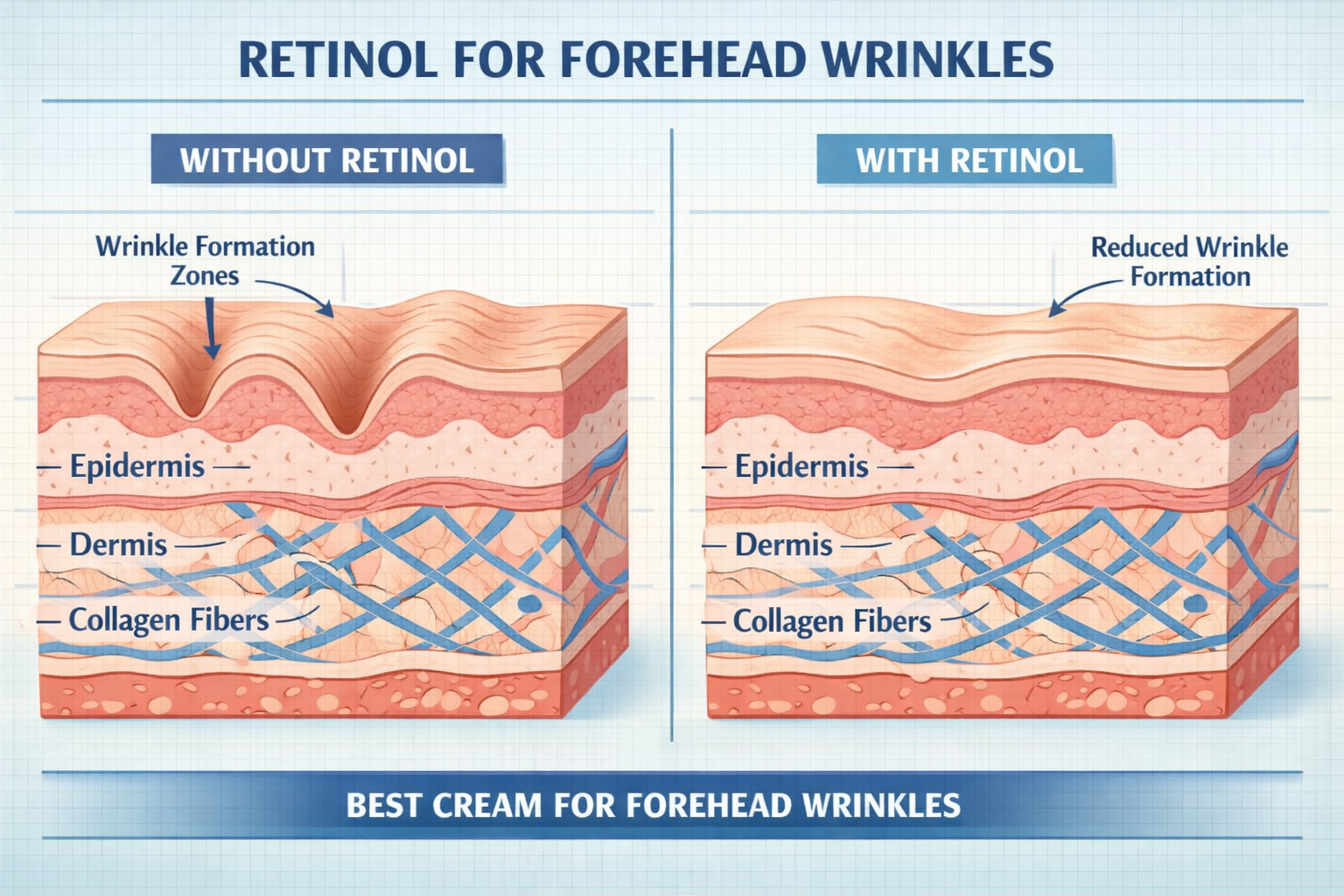 Detailed () editorial illustration showing a cross-section diagram of forehead skin layers with labeled annotations: